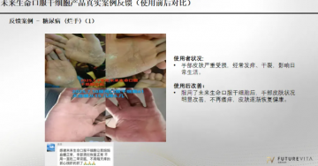 “Futurevita未来生命”：包装成海外健康项目，能治疗各种疾病？